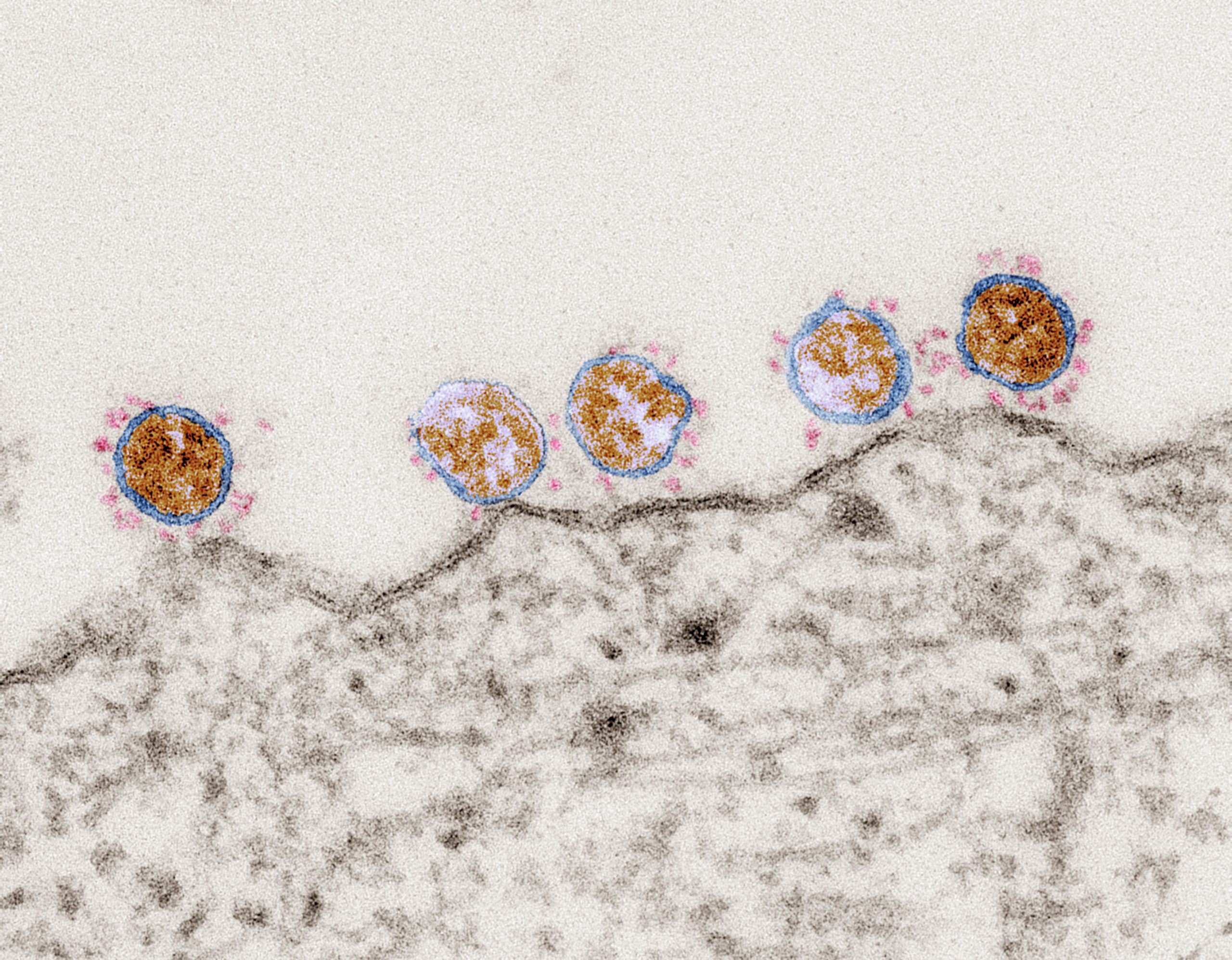 SARS-Coronavirus-2 (SARS-CoV-2, Isolat SARS-CoV-2/Italy-INMI1). Elektronenmikroskopie. Ultradünnschnitt durch eine Verozelle mit Viruspartikeln auf der Oberfläche. Maßstab: 100 nm. Quelle: Tobias Hoffmann, Robert Koch-Institut (RKI), 2020.