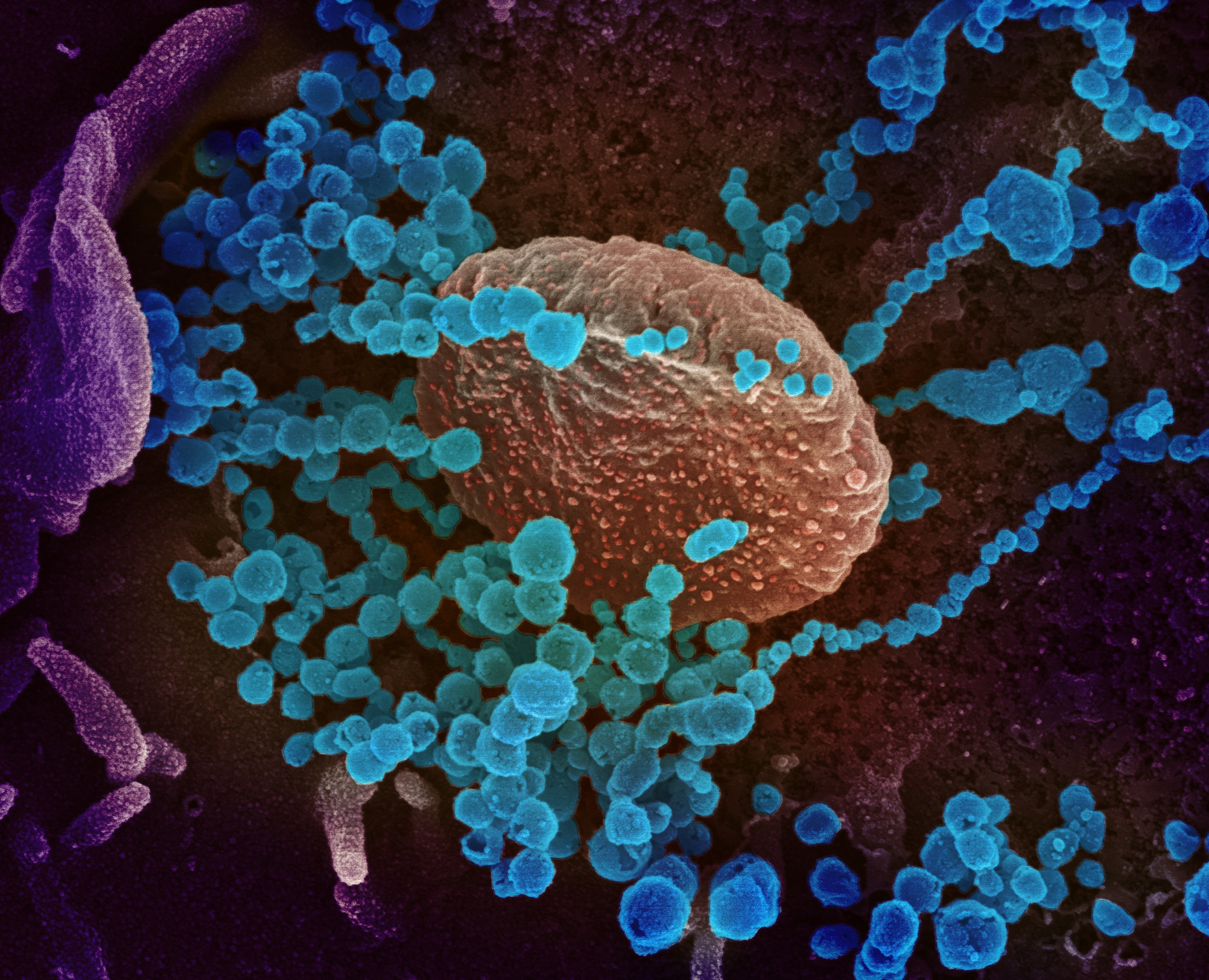 This scanning electron microscope image shows SARS-CoV-2 (round blue objects) emerging from the surface of cells cultured in the lab. SARS-CoV-2, also known as 2019-nCoV, is the virus that causes COVID-19. The virus shown was isolated from a patient in the U.S. Image captured and colorized at NIAID's Rocky Mountain Laboratories (RML) in Hamilton, Montana.