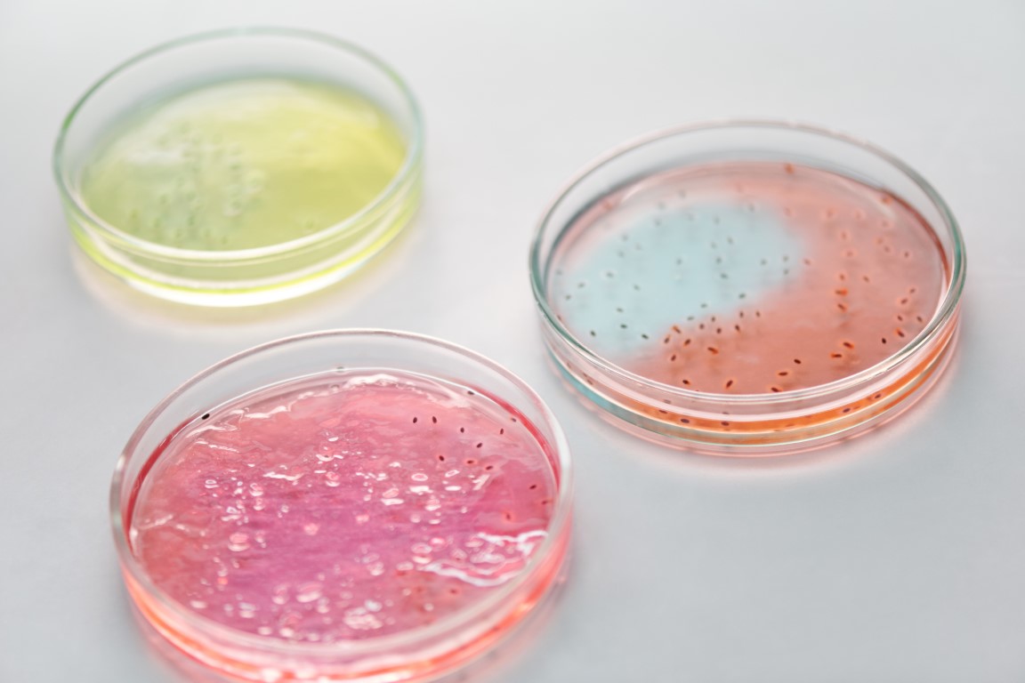 Foto von drei Petrischalen mit bunt eingefärbten Nährmedien und darauf befindlichen Kolonien