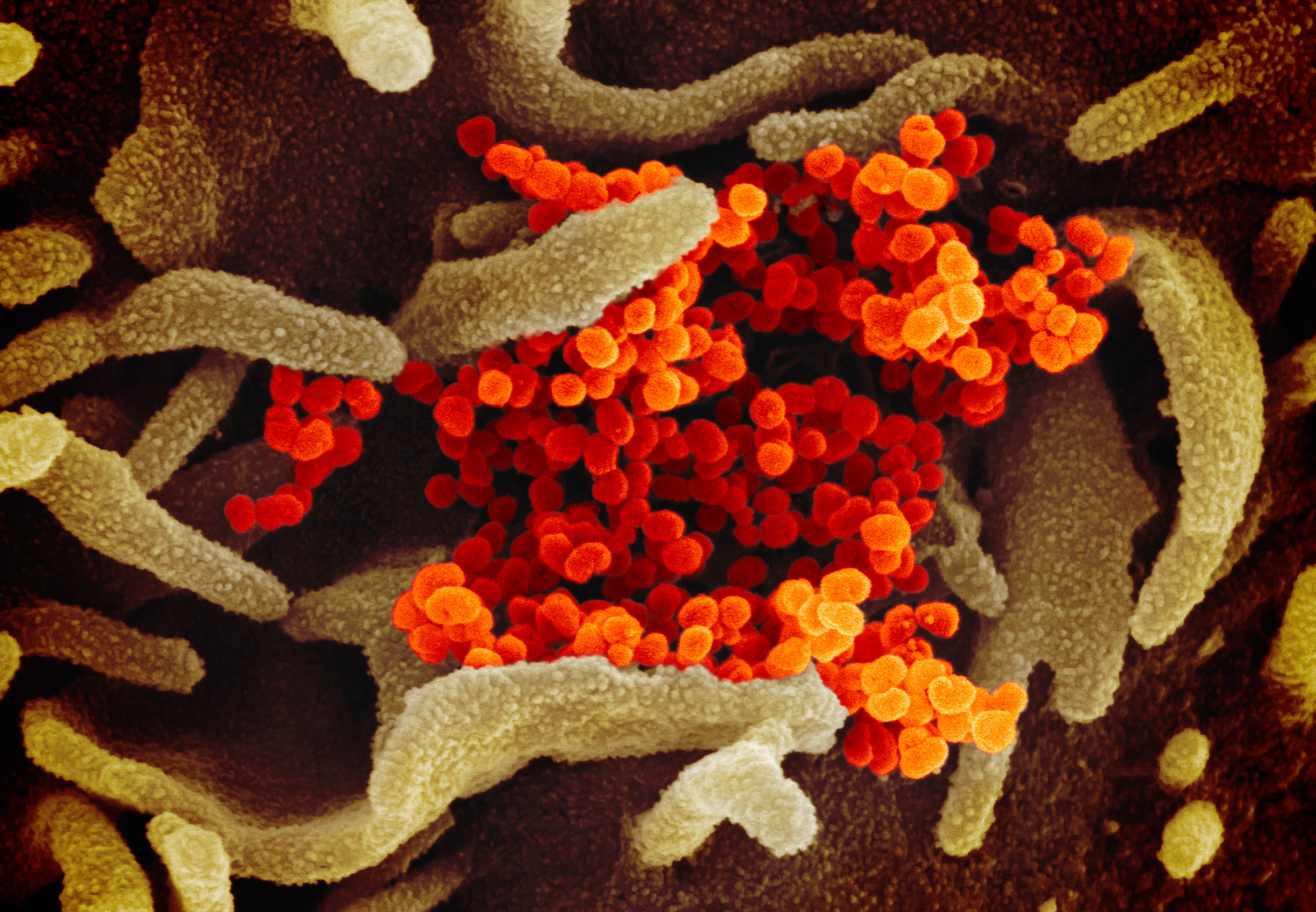 This scanning electron microscope image shows SARS-CoV-2 (orange)—also known as 2019-nCoV, the virus that causes COVID-19—isolated from a patient in the U.S., emerging from the surface of cells (green) cultured in the lab. Image captured and colorized at NIAID's Rocky Mountain Laboratories (RML) in Hamilton, Montana.